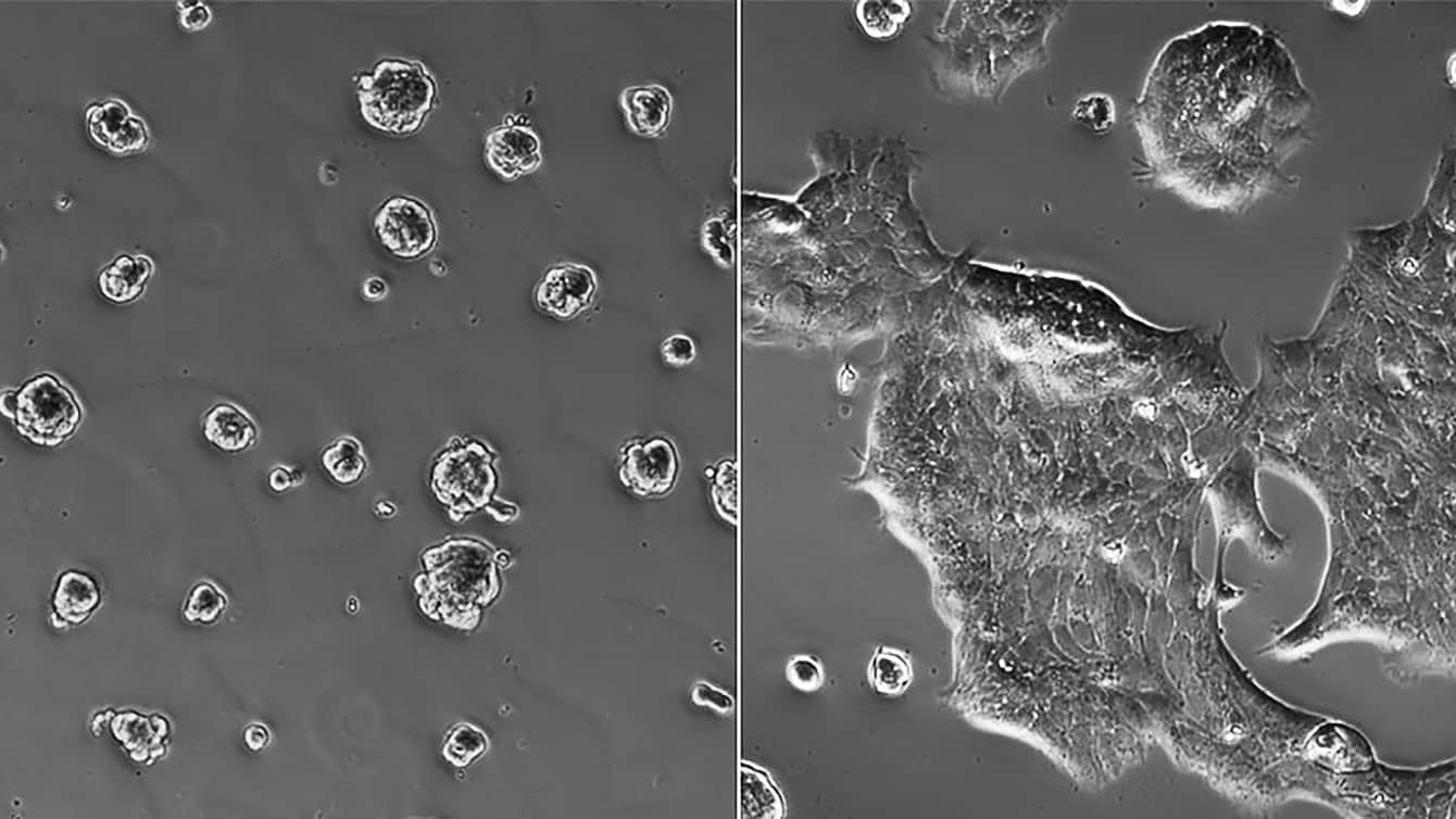 Images of cells that lead to breast-cancer progression in laboratory cultures