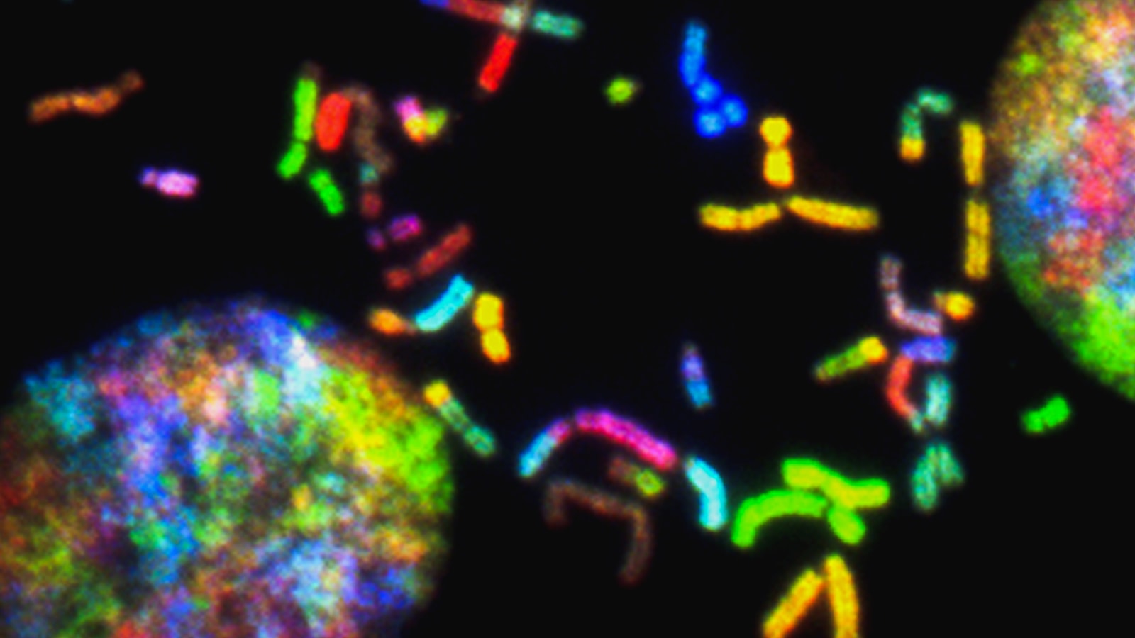 Colorful image of brain cancer chromosomes