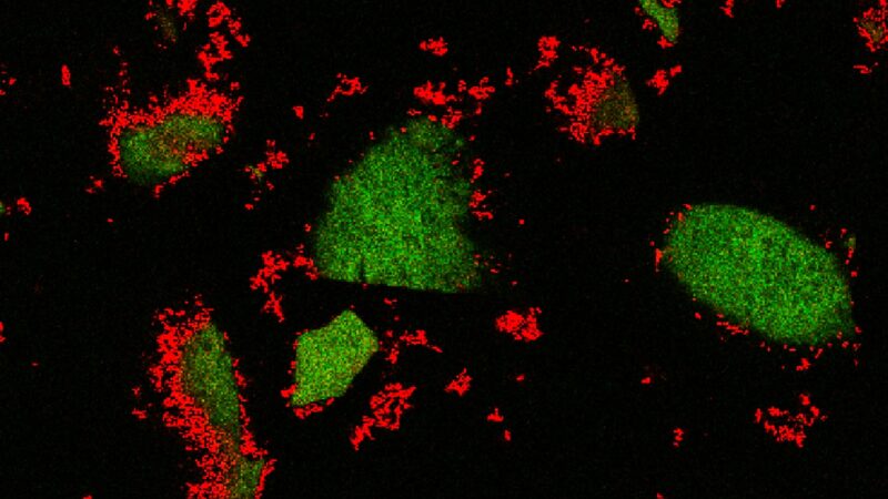 Large aggregates of glucose shown in green; bacteria grow around them, labeled in red