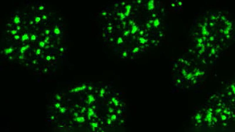 Fluorescent green droplets inside a cell