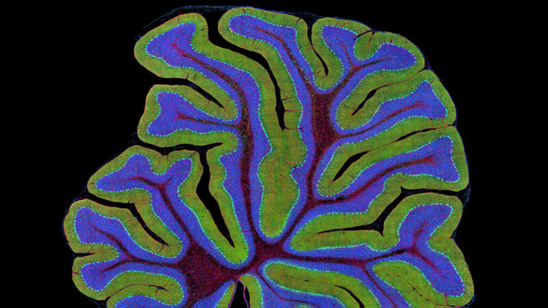 Microscope image of the brain's cerebellum, showing multiple folds and layers labeled in green and blue.