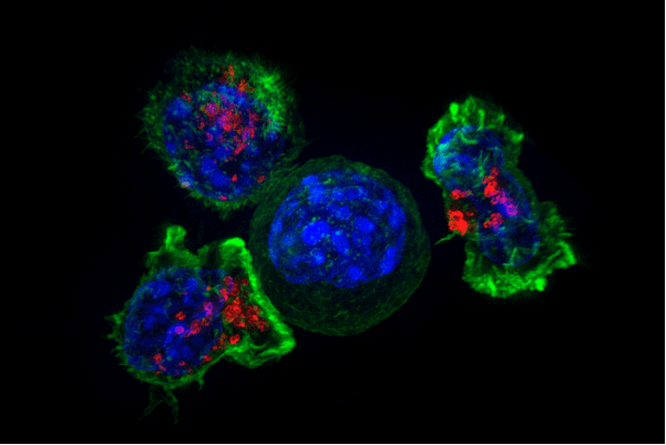 A group of killer T cells, colored green and red, surrounding a cancer cell, colored blue.