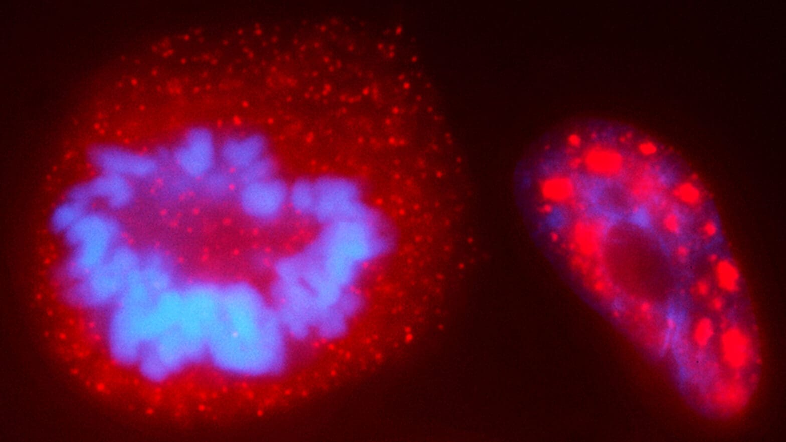 false color microscope image of a cell nucleus with chromosomes highlighted.