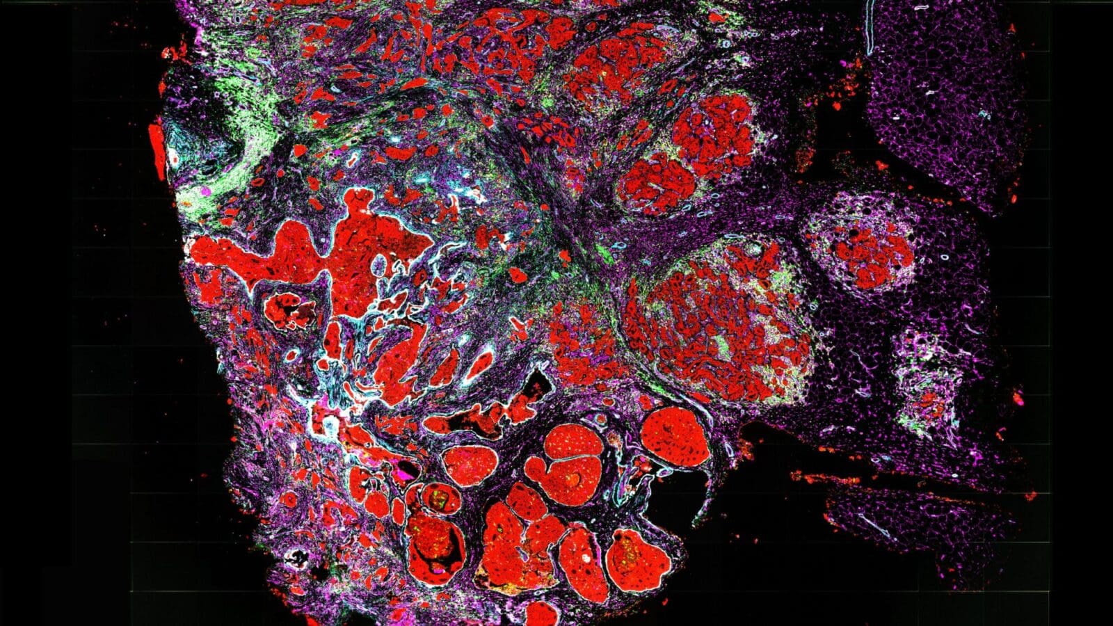 image of breast tissue showing different colored cells