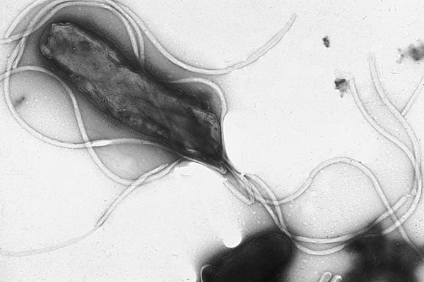 A black and white microscope image depicting a bacterial cell with several long, threadlike appendages.