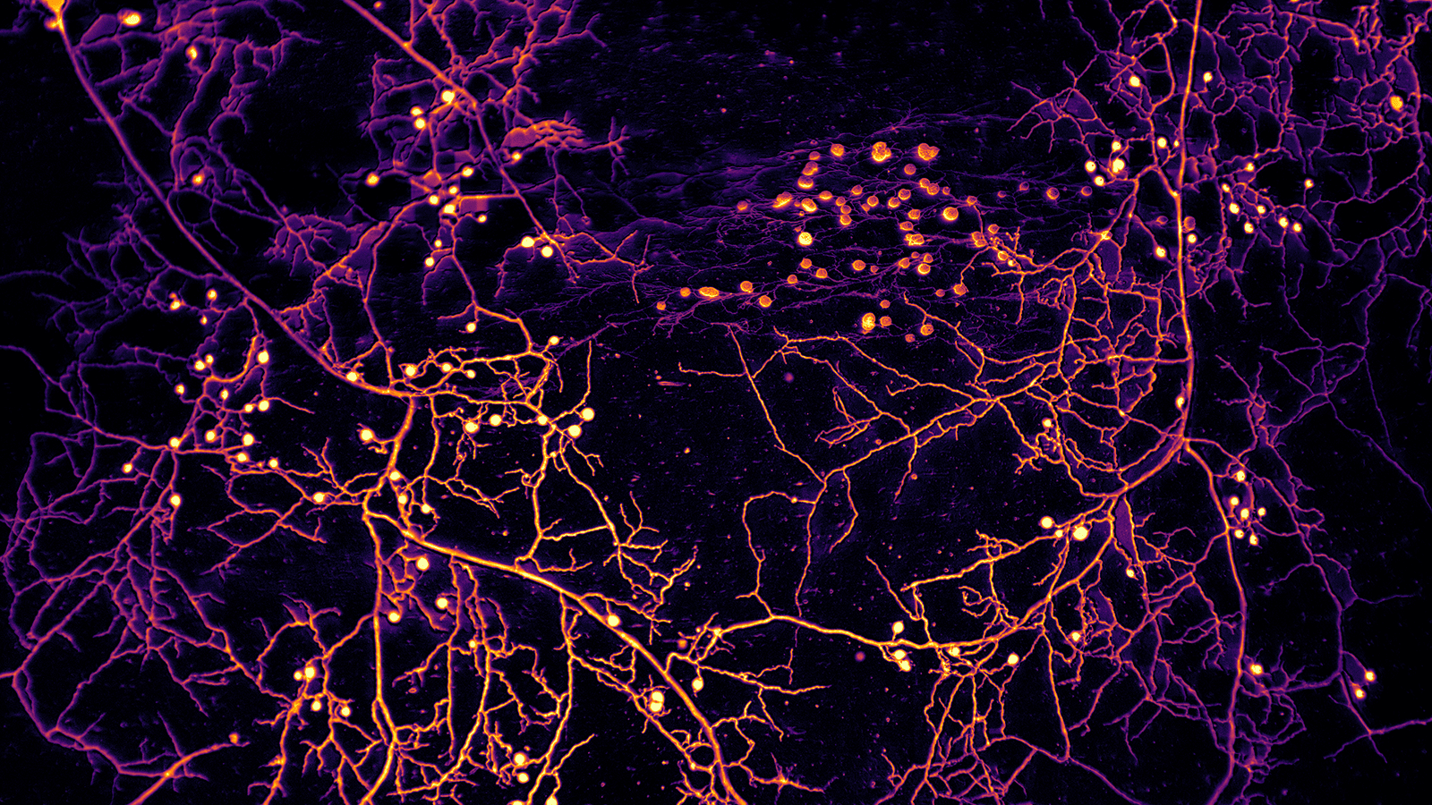 Branching filaments studded with spore sacs all in false color to indicate depth.