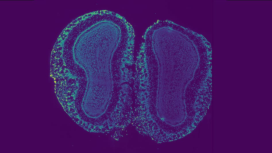 Tissue sample from a mouse's olfactory bulb