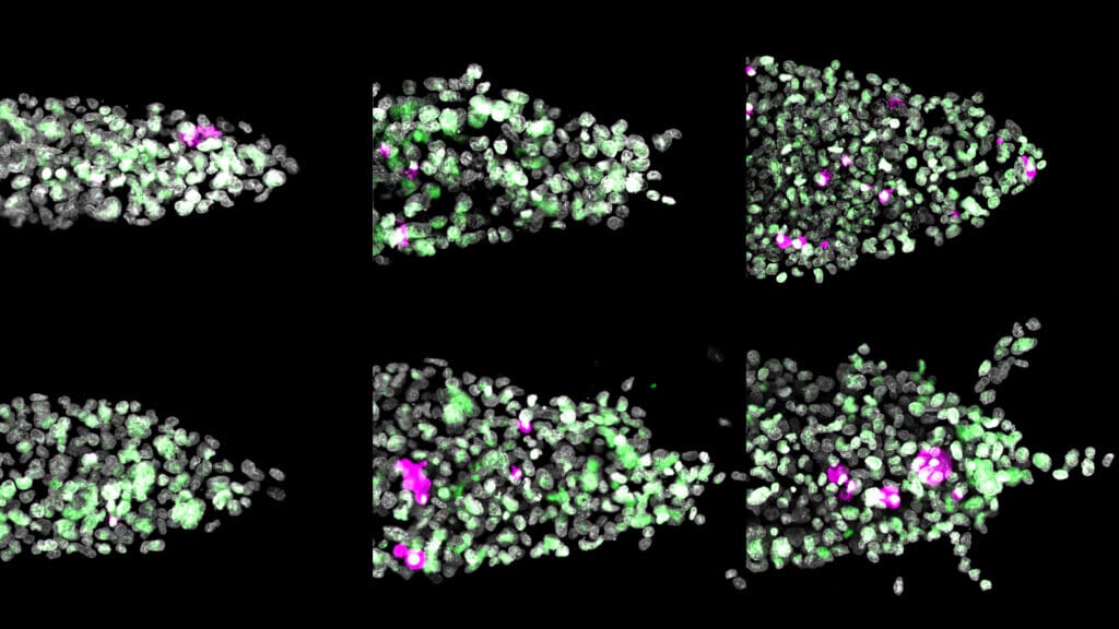 Six images of tumor cells show branch-like structure emerging in the last image