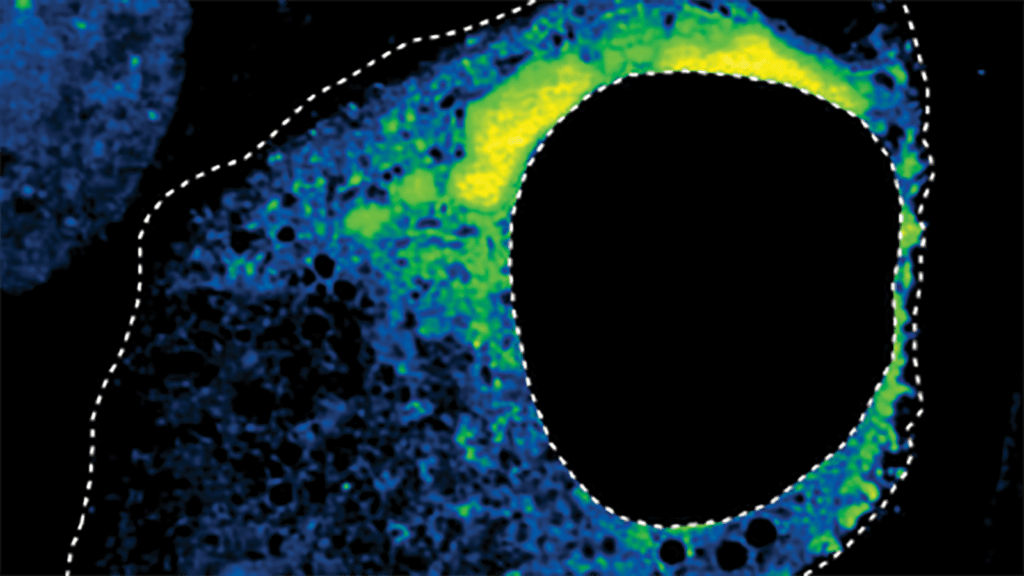 Microscope image of an RSV-infected cell